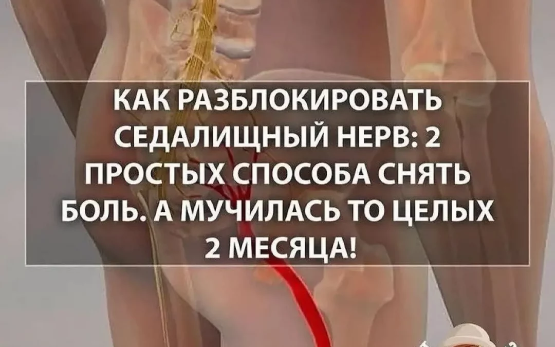 Седалищный нерв.